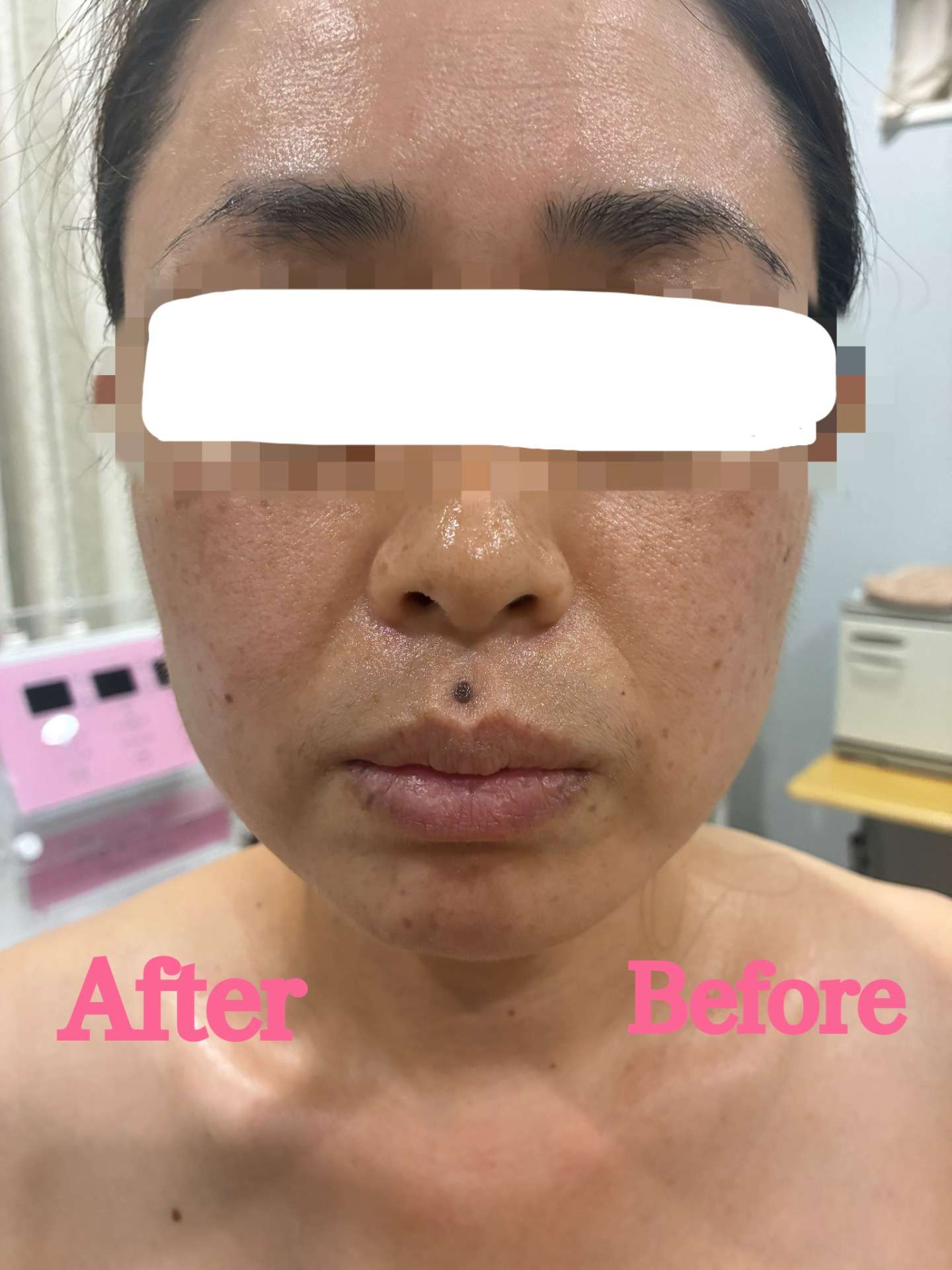 一気にお肌悩み改善♪