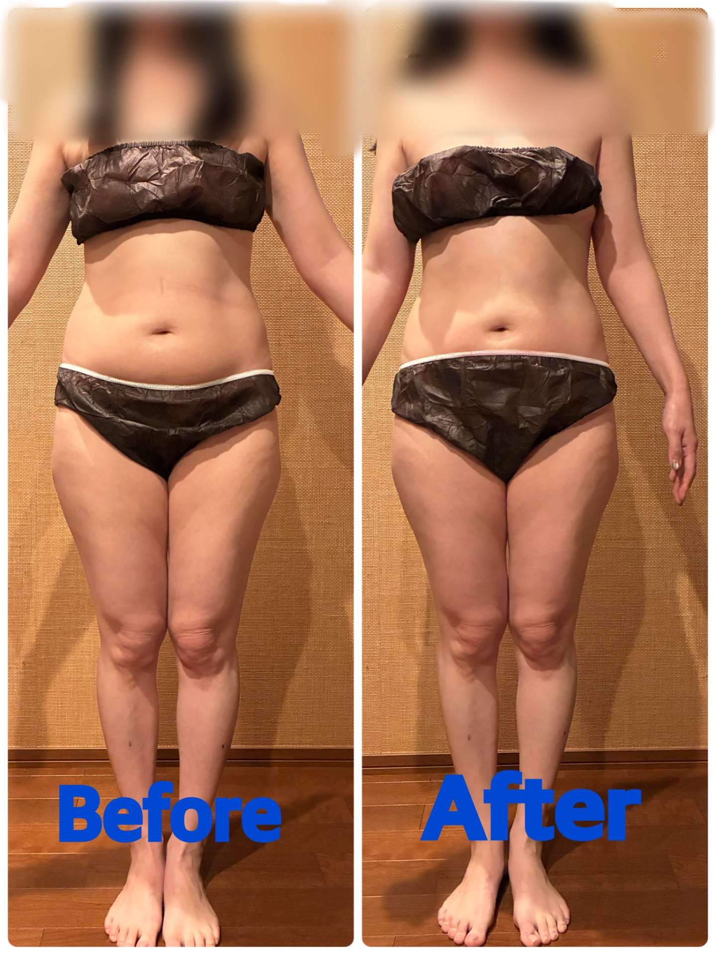 効果実感して頂ける施術！！