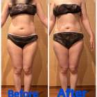 効果実感して頂ける施術！！